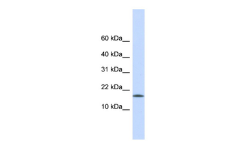 CENPA Rabbit Polyclonal Antibody