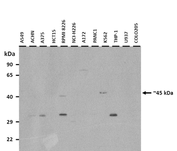 CTH Rabbit Polyclonal Antibody