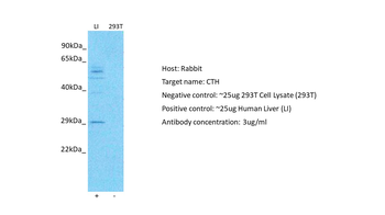 CTH Rabbit Polyclonal Antibody