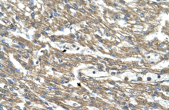 CTH Rabbit Polyclonal Antibody