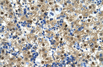 CTPS Rabbit Polyclonal Antibody