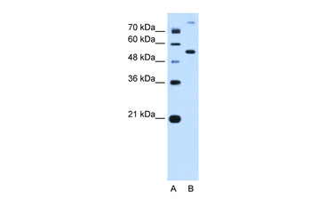 PPAT Rabbit Polyclonal Antibody