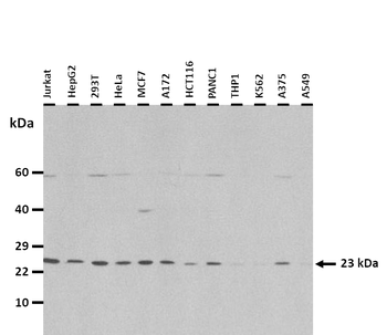 PSMB9 Rabbit Polyclonal Antibody