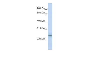 PSMB9 Rabbit Polyclonal Antibody