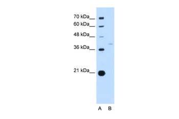 RFC3 Rabbit Polyclonal Antibody
