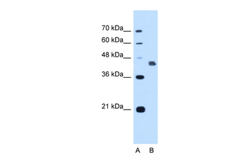 GSDME Rabbit Polyclonal Antibody