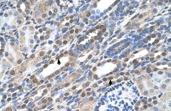 NOLC1 Rabbit Polyclonal Antibody