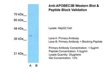 APOBEC3B Rabbit Polyclonal Antibody