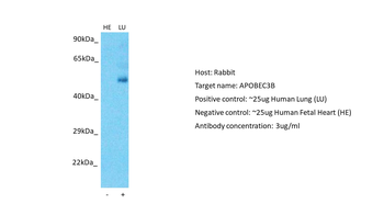APOBEC3B Rabbit Polyclonal Antibody