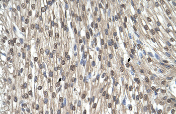 SHMT2 Rabbit Polyclonal Antibody