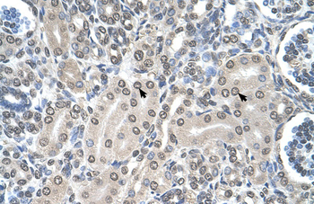 SHMT2 Rabbit Polyclonal Antibody