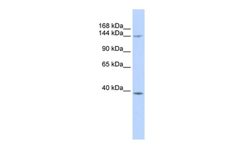 SMC4 Rabbit Polyclonal Antibody