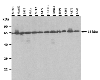 STIP1 Rabbit Polyclonal Antibody