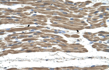 STIP1 Rabbit Polyclonal Antibody