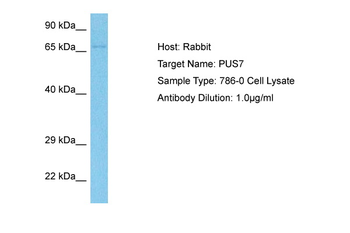 PUS7 Rabbit Polyclonal Antibody