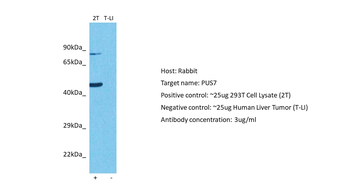 PUS7 Rabbit Polyclonal Antibody