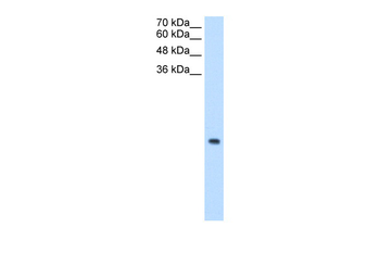 MRPS12 Rabbit Polyclonal Antibody