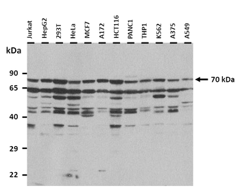RMI1 Rabbit Polyclonal Antibody