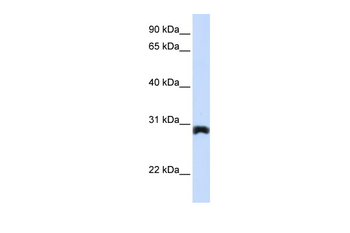PEX11A Rabbit Polyclonal Antibody