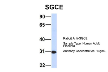 SGCE Rabbit Polyclonal Antibody