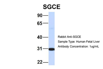 SGCE Rabbit Polyclonal Antibody