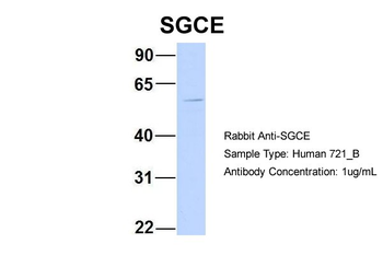 SGCE Rabbit Polyclonal Antibody
