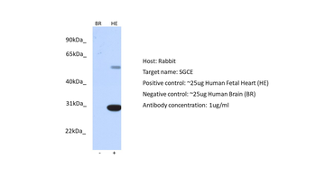 SGCE Rabbit Polyclonal Antibody
