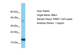 NINJ1 Rabbit Polyclonal Antibody