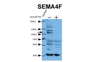 SEMA4F Rabbit Polyclonal Antibody