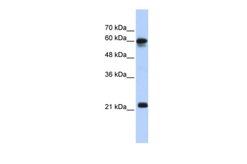SEMA4F Rabbit Polyclonal Antibody