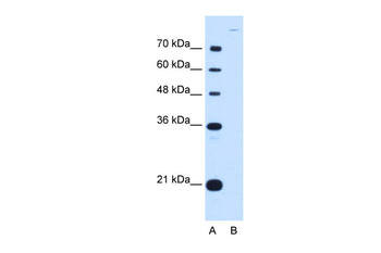 CDH7 Rabbit Polyclonal Antibody