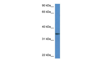 Dhrs3 Rabbit Polyclonal Antibody