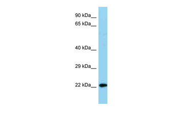 Ndufb8 Rabbit Polyclonal Antibody