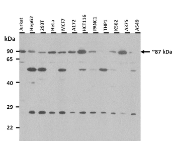 ATP6V0A1 Rabbit Polyclonal Antibody