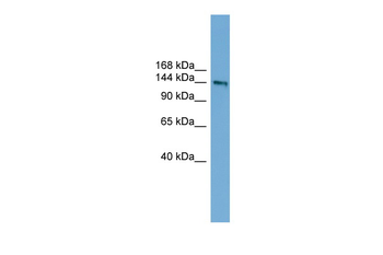 DCC Rabbit Polyclonal Antibody