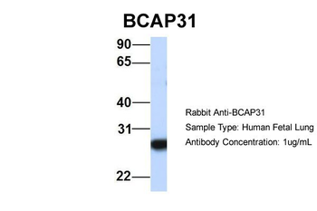 BCAP31 Rabbit Polyclonal Antibody