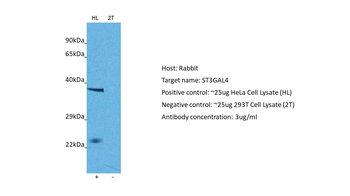 ST3GAL4 Rabbit Polyclonal Antibody