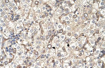 ST3GAL4 Rabbit Polyclonal Antibody
