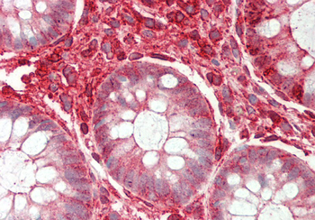 ST3GAL4 Rabbit Polyclonal Antibody