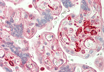 ST3GAL4 Rabbit Polyclonal Antibody