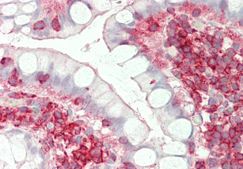 ST3GAL4 Rabbit Polyclonal Antibody