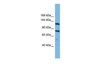 HYOU1 Rabbit Polyclonal Antibody