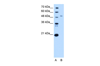 SPTLC1 Rabbit Polyclonal Antibody