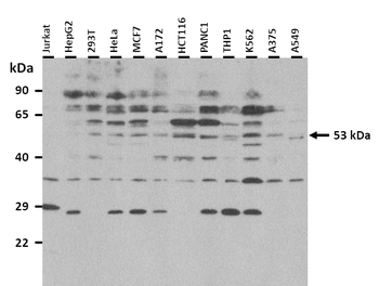 SPTLC1 Rabbit Polyclonal Antibody