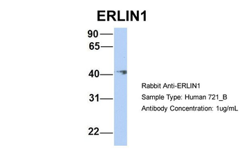 ERLIN1 Rabbit Polyclonal Antibody