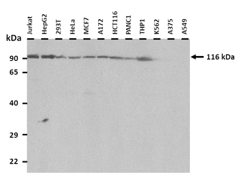 CORIN Rabbit Polyclonal Antibody