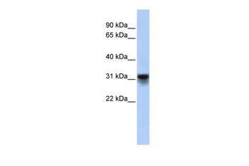 KDELR3 Rabbit Polyclonal Antibody