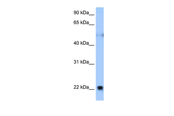 RTN4 Rabbit Polyclonal Antibody