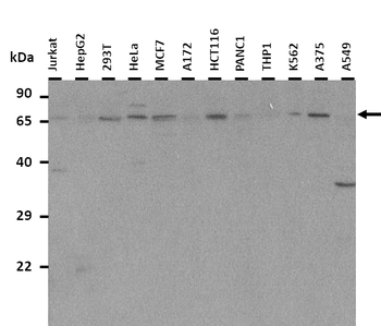 NOX1 Rabbit Polyclonal Antibody