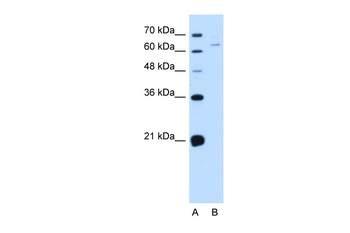 NOX1 Rabbit Polyclonal Antibody